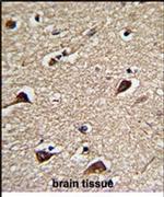PGLS Antibody in Immunohistochemistry (IHC)