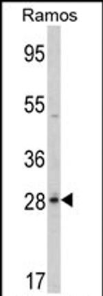 PGLS Antibody in Western Blot (WB)