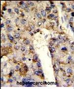 hnRNP L Antibody in Immunohistochemistry (IHC)