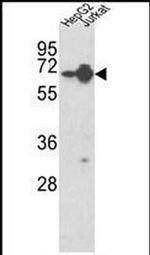hnRNP L Antibody in Western Blot (WB)