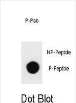 Phospho-TSC1 (Thr417) Polyclonal Antibody
