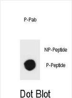 Phospho-TSC1 (Tyr297) Polyclonal Antibody