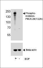 Phospho-PIK3C2B (Tyr228) Polyclonal Antibody