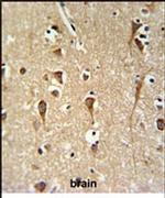 ZCCHC24 Antibody in Immunohistochemistry (IHC)