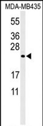ZCCHC24 Antibody in Western Blot (WB)