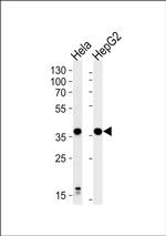 P2Y13 Antibody in Western Blot (WB)