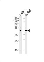 AVPR2 Antibody in Western Blot (WB)
