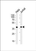 Protease-Activated Receptor-4 Antibody in Western Blot (WB)