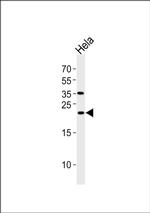 UBE2T Antibody in Western Blot (WB)