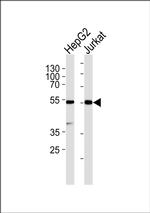Protease-Activated Receptor-4 Antibody in Western Blot (WB)