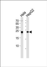 MRRF Antibody in Western Blot (WB)