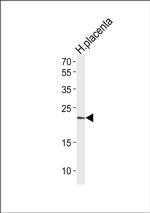 HES2 Antibody in Western Blot (WB)