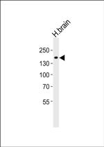 KCNT1 Antibody in Western Blot (WB)