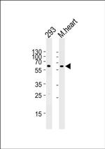 HAS2 Antibody in Western Blot (WB)