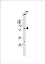 CPNE8 Antibody in Western Blot (WB)