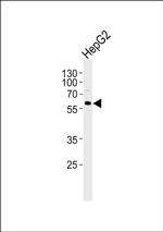 FIBB Antibody in Western Blot (WB)