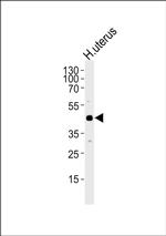TIM-1 Antibody in Western Blot (WB)