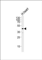 KLF2 Antibody in Western Blot (WB)