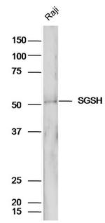 SGSH Antibody in Western Blot (WB)