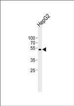 DHCR7 Antibody in Western Blot (WB)
