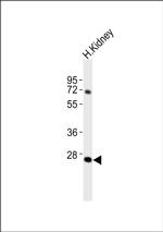 ABHD12B Antibody in Western Blot (WB)