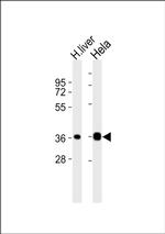 Apolipoprotein F Antibody in Western Blot (WB)