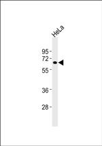 C1r Antibody in Western Blot (WB)