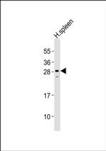 Carbonic Anhydrase I Antibody in Western Blot (WB)