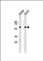 CYP2J2 Antibody in Western Blot (WB)