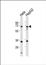 NEIL3 Antibody in Western Blot (WB)