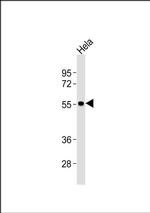 ENT1 Antibody in Western Blot (WB)