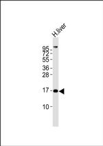 MGST2 Antibody in Western Blot (WB)