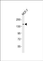 NACAD Antibody in Western Blot (WB)
