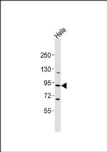 RASA4 Antibody in Western Blot (WB)