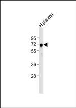 ALS Antibody in Western Blot (WB)