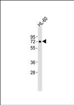 ASM Antibody in Western Blot (WB)