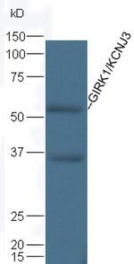 Kir3.1 (KCNJ3) Antibody in Western Blot (WB)