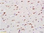 NOX4 Antibody in Immunohistochemistry (Paraffin) (IHC (P))