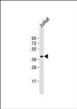 FAM84B Antibody in Western Blot (WB)