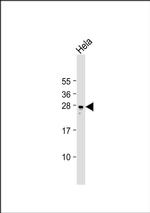 RAB34 Antibody in Western Blot (WB)
