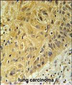 WNT5A Antibody in Immunohistochemistry (Paraffin) (IHC (P))