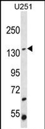 ST5 Antibody in Western Blot (WB)
