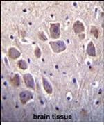 RCAN2 Antibody in Immunohistochemistry (IHC)