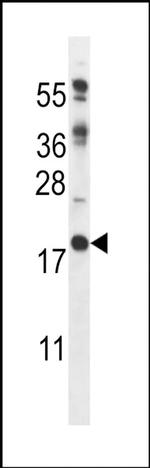 RCAN2 Antibody in Western Blot (WB)