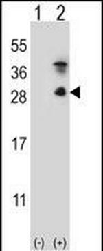 Kallikrein 7 Antibody in Western Blot (WB)