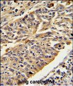 Cathepsin E Polyclonal Antibody