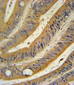 WNT10B Polyclonal Antibody