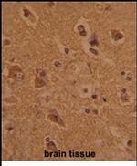 FCP1 Antibody in Immunohistochemistry (IHC)