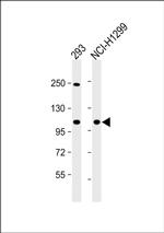 FCP1 Antibody in Western Blot (WB)