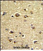 GAS7 Antibody in Immunohistochemistry (IHC)